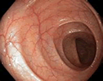 出典：人間の胃腸
intestine&fr=uh3_news_web_gs#id